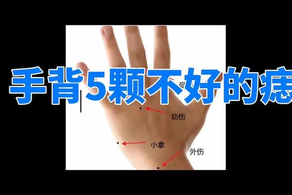 痣相手背上有痣好不好看;手背上有痣说明什么