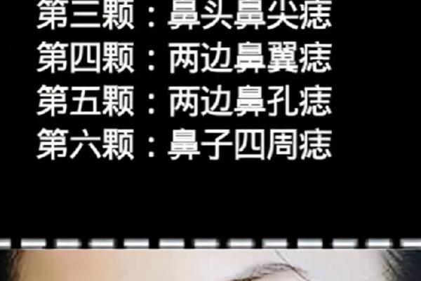 痣相 女 鼻头下有痣、女人鼻头长痣图解 痣相 女 鼻头下有痣、女人鼻头长痣图解