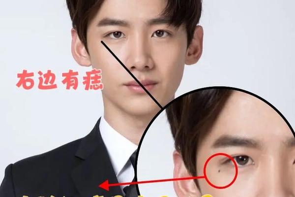 人相什么叫眼泪痣、眼角下的泪痣代表什么