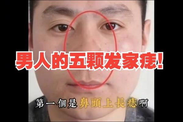 麻衣神相男人左耳有痣(左耳朵有痣的男人好不好)