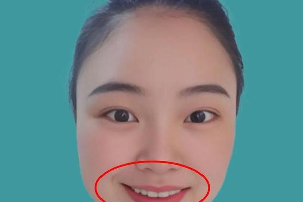 痣相是好是坏怎么看-痣相口舌是什么意思