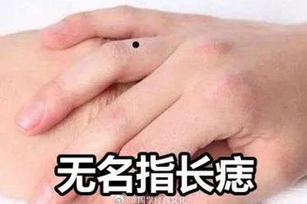 无名指有痣相-无名指痣相图解