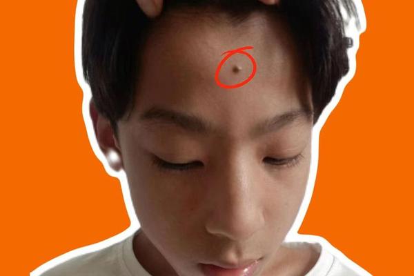 男人额头有痣相,眉间有痣的男人