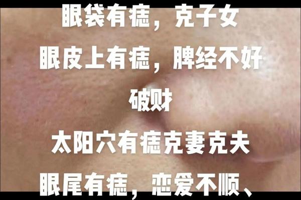 克夫的痣相、克夫痣图片