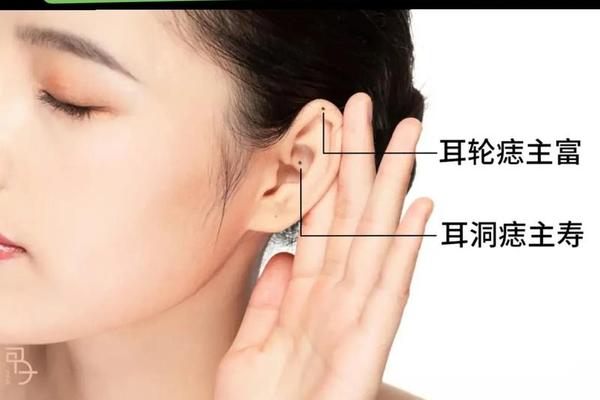看痣相说好痣什么意思,耳朵哪里的痣有福气图
