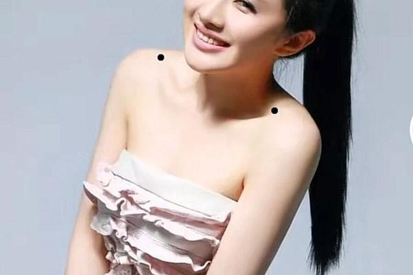 女人肩上后有痣相—女人痣相图解 女人肩上后有痣相—女人痣相图解