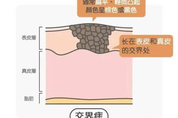 女人外阴有痣啥相—女人下面有痣有什么说法