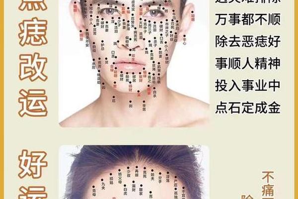 痣相美学(什么是美痣什么是恶痣)