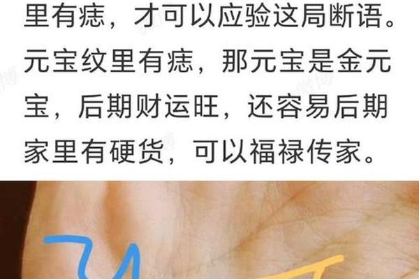 男手上痣相;手上痣相图解