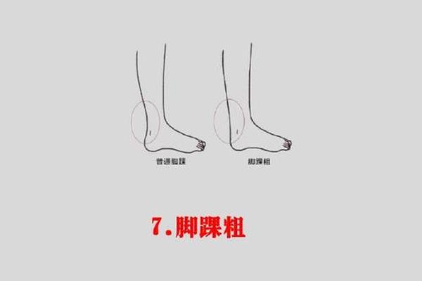 女孩小腿痣相;女人小腿长痣图解