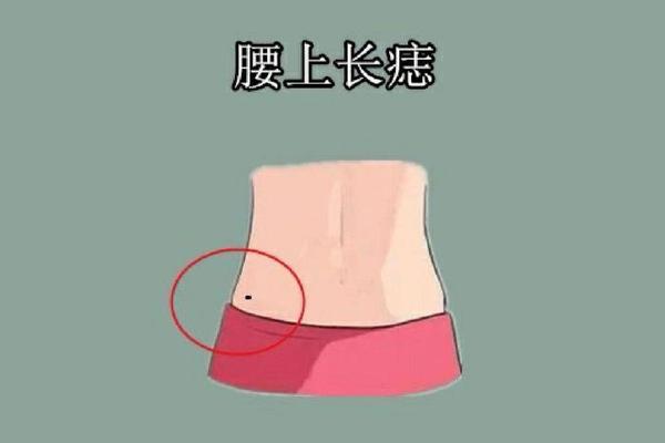 男人右腰上长痣图相;右后腰有痣的男人代表什么