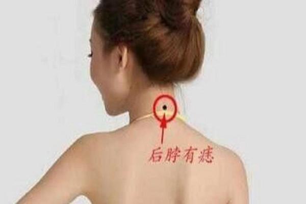 后脖子痣相—脖子后面有痣图解