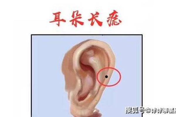 耳根痣相法,脸部长痣位置说法图