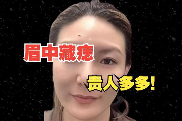 麻衣神相眉正中间有颗痣;鼻梁眉毛中间有颗痣