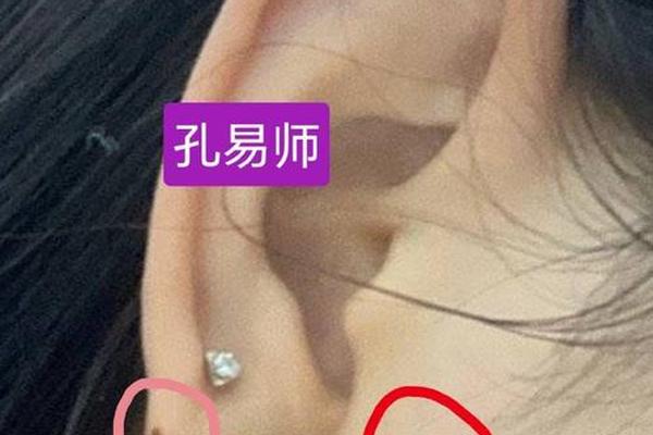 麻衣相耳垂前边有痣好不好_耳垂下有痣图解