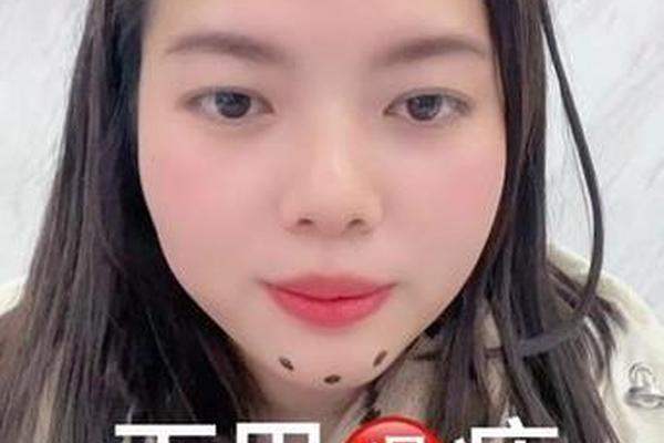 不巴痣吉利之相 下巴哪个地方有痣最好