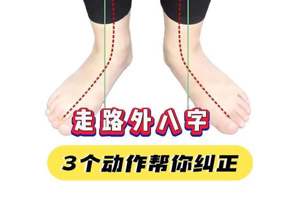 外八字走路怎么矫正