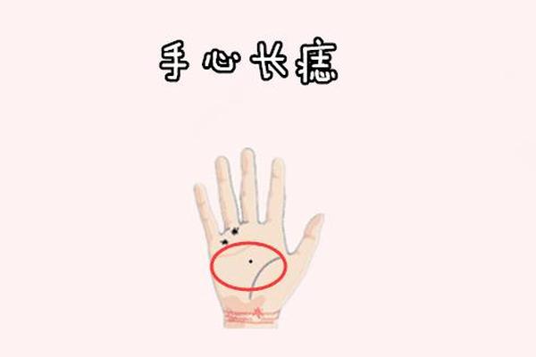 痣相 左手手掌根部长痣_手掌根有痣