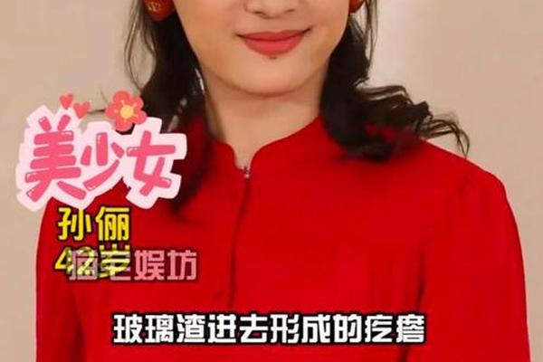 孙俪痣相-孙俪嘴巴那颗痣是怎么来的