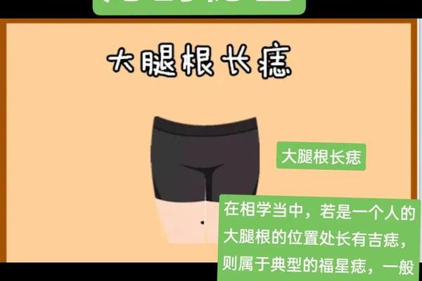 右滕盖上的痣相(右膝盖有痣的女人图解)