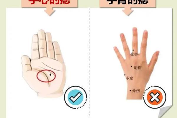 女人右手手背长痣是旺夫相吗(女人右手手背突然长痣)