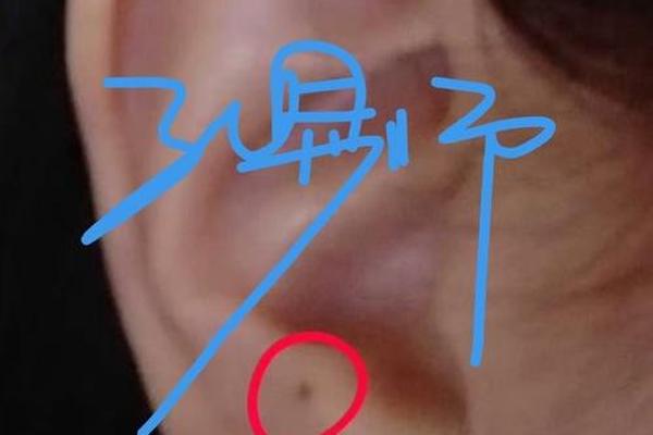 耳轮有痣的男生痣相 耳轮有痣的男人好不好