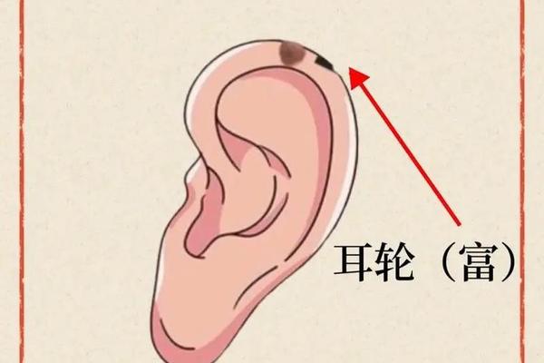 耳边痣相女人(耳朵痣相图解大全女人)