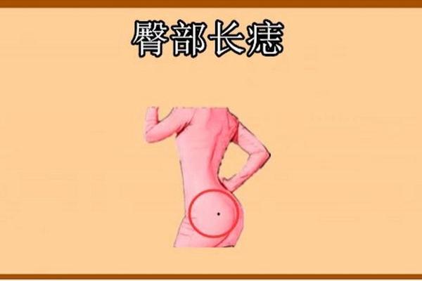 男人屁股顶端长痣相说-屁股痣相图解10大福痣
