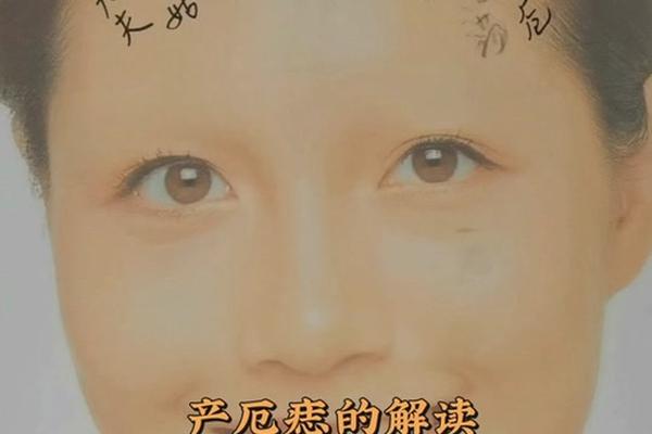 痣相厄门是什么意思;厄门痣好不好