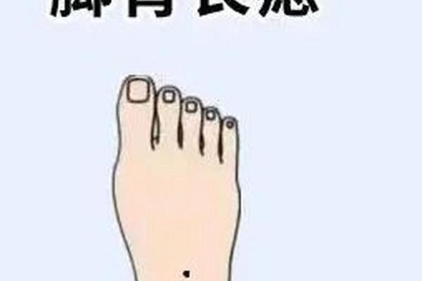 右脚长有一颗大痣脚相 右脚脚背有痣代表什么