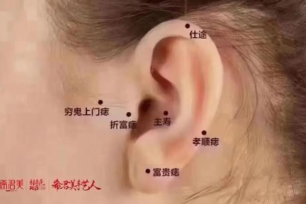 耳朵面相痣相 耳朵长痣好不好