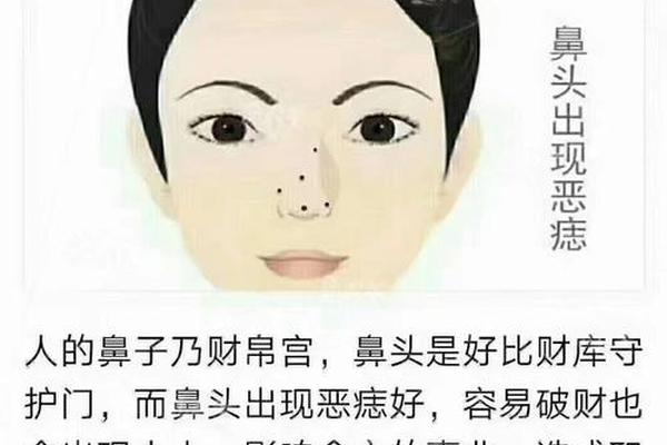 麻衣相鼻子上有痣_鼻梁上的痣好不好