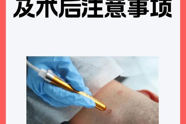 相城医院点痣价格表图;医院点痣一般怎么收费