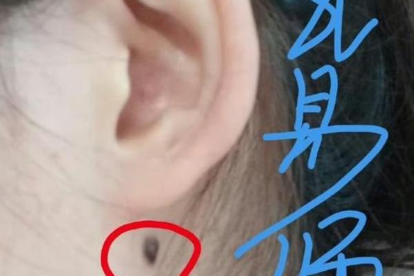 痣相耳朵后面脖子、耳后脖子长痣代表什么意思 痣相耳朵后面脖子、耳后脖子长痣代表什么意思