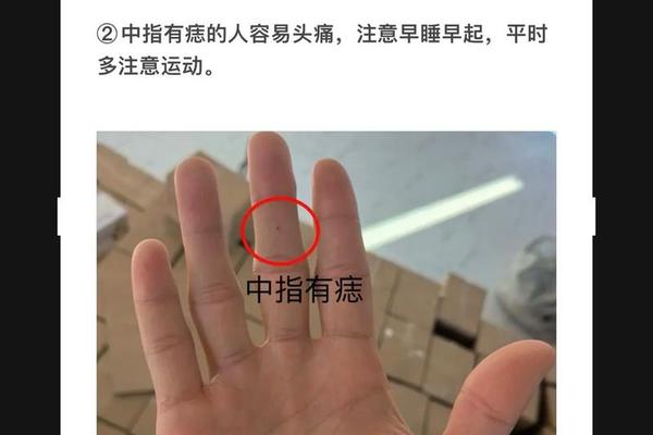 痣相女人手指相图解(女人手指侧面长痣图解) 痣相女人手指相图解(女人手指侧面长痣图解)