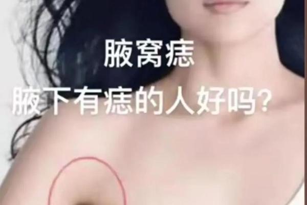 女相痣在左侧腋下,腋窝长痣左边女的