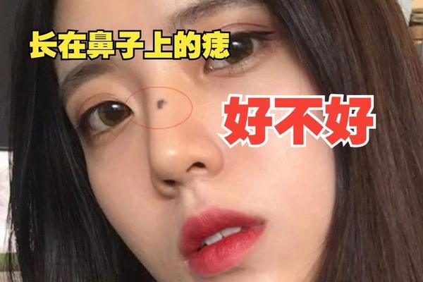 鼻孔下有颗痣女相(鼻孔前有颗痣好不好)