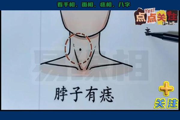 麻衣神相后脖子长痣好吗 极少见的富贵痣