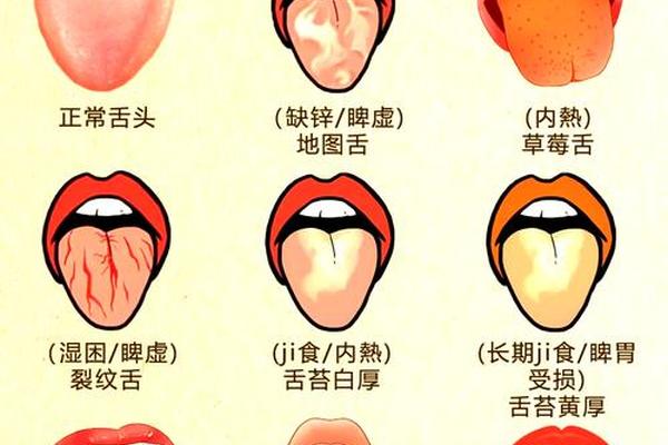 舌头长痣相的象征意义—舌头长痣从命学解释