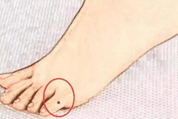 脚侧面痣相解析(脚侧面长痣图解)