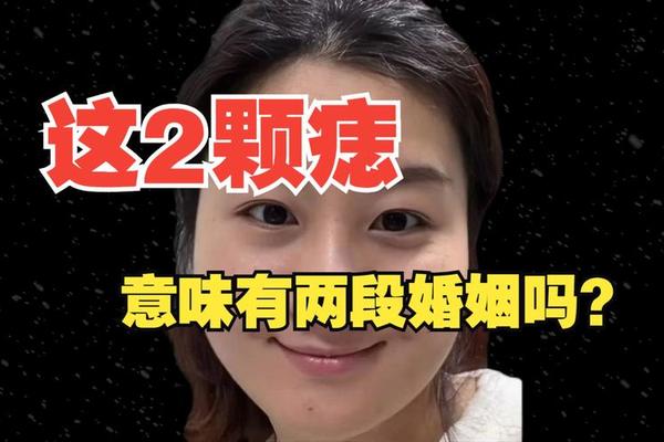 婚姻坎坷的痣相—婚姻天注定半点不由人