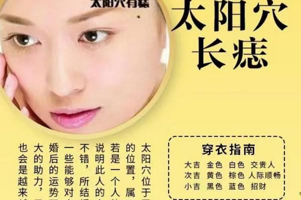 痣相太阳穴长痦子;头顶上长痦子命运图