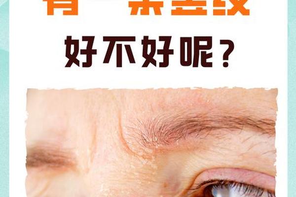 眉头痣相竖纹_眉心有竖纹好不好