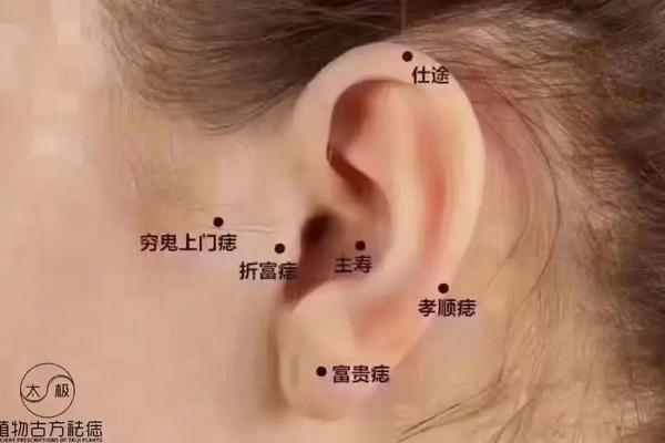 麻衣相耳上有痣(麻衣神相耳朵真人图片)