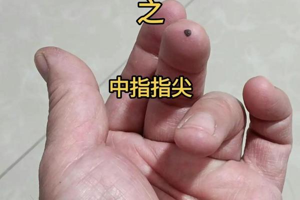 痣相男士左手中指有痣_女的左手中指有痣图解 痣相男士左手中指有痣_女的左手中指有痣图解