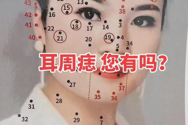 痣相耳朵部位,痣在耳朵图片大全