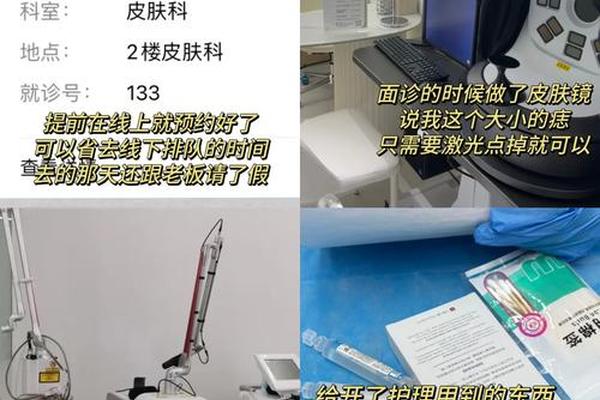 相城激光点痣医院在哪里_激光点痣疼吗