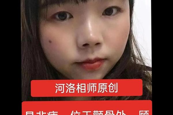 红痣相;大师说红色的痣含义 红痣相;大师说红色的痣含义