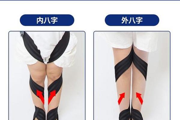 内八字脚矫正器的危害