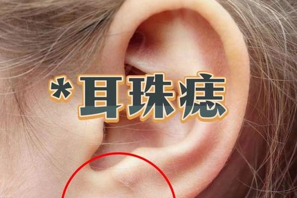耳垂有痣的女人痣相—女人左耳垂有痣